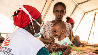 Yordanos, malnourished child, Um rakuba