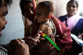 Malnutrition in Bihar, India