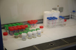 (DR-TB) Patient Diagnose and Treatment | laboratory