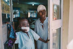  Umar and Adamu - Noma Survivors
