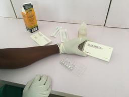 Lassa Fever - Abakaliki