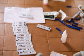 Malaria tests at MSF mobile clinic in Zero Transit Centre in Renk
