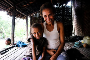 Arduous and lengthy treatment of tuberculosis