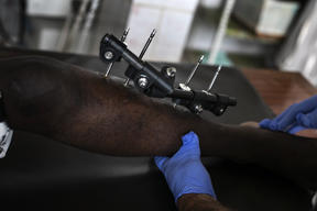 A hospital at the heart of violence-torn North-West Cameroon