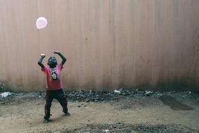 Umar - Noma Survivor