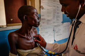 Malawi - Advanced HIV