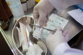Cutaneous Leishmaniasis Treatment | Aftercare Preparation