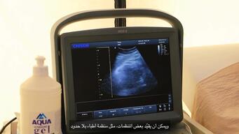 WEB CLIP Horizontal AR SYRIA Crossborder resolution