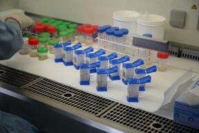 (DR-TB) Patient Diagnose and Treatment | laboratory