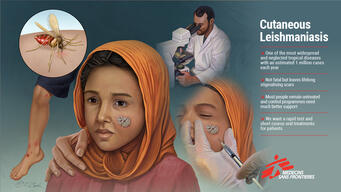 Twitter card EN Cutaneous Leishmaniasis