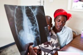 HIV/Aids in Zimbabwe