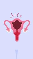What Does it Feel Like to Have an Abortion with Pills?  - French - Vertical