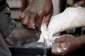 Physiotherapy at SICA hospital, Bangui